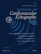 Journal of cardiovascular echography.