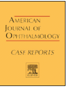 American journal of ophthalmology.