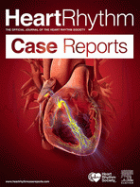 HeartRhythm case reports.