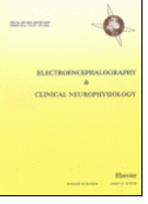 Electroencephalography and clinical neurophysiology.