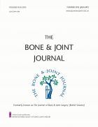 The Journal of bone and joint surgery.