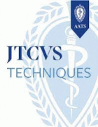 JTCVS techniques.