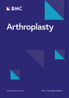 Arthroplasty.