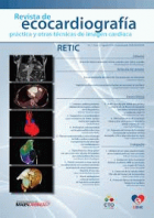 Revista de ecocardiografía práctica y otras técnicas de imagen cardíaca.