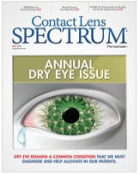 Contact lens spectrum.